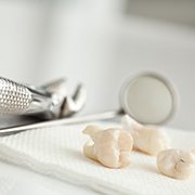 Teeth lying on cloth next to dental instruments after tooth extraction in Pepper Pike, OH